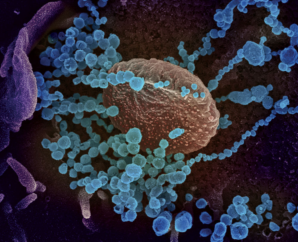 Coronavirus: des mutations incessantes mais pas forcément plus dangereuses