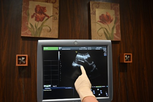 Don d'ovocytes dans un couple de femmes: le gouvernement est "contre", dit Véran