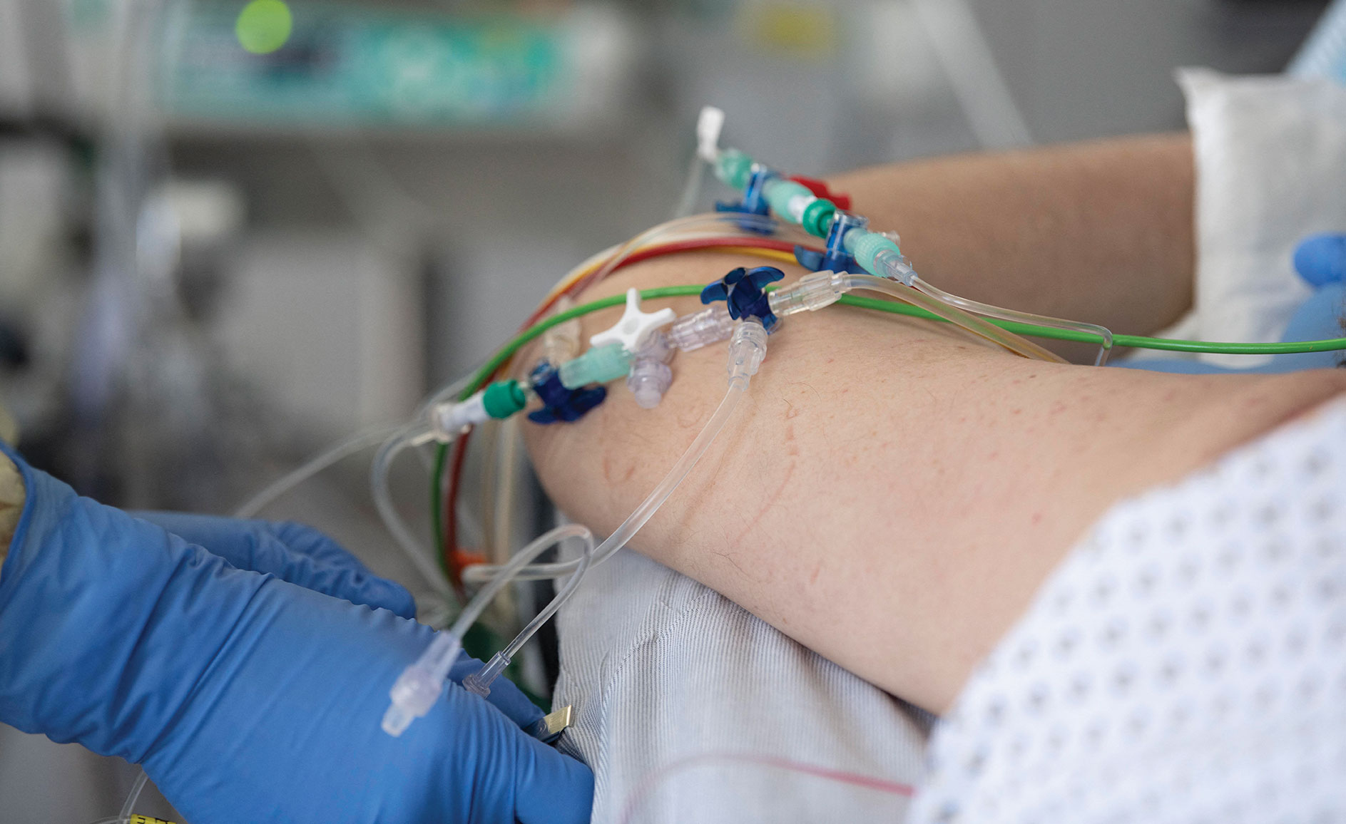 Epidémie: le tri des malades dans les hôpitaux, une "ligne rouge absolue", affirme Le Maire