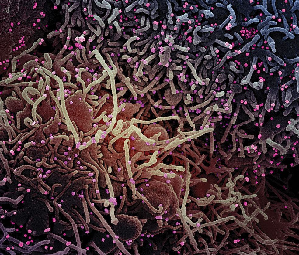 Handout / National Institute of Allergy and Infectious Diseases / AFP