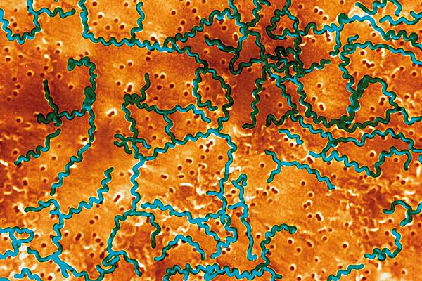 Leptospires, agents de la leptospirose, vus au microscope.