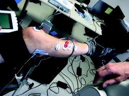 La stimulation électrique au secours de la paralysie