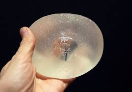 Implants PIP: pas de retrait préventif requis, selon les experts de la Commission Européenne