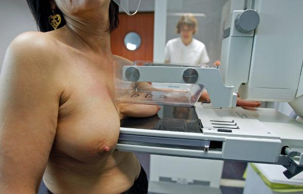 La mammographie en 3D plus efficace pour dépister des cancers du sein