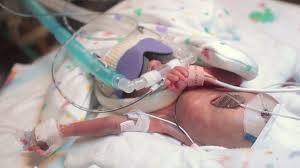 Les parents d'un grand prématuré refusent l'acharnement thérapeutique