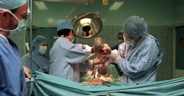 Le Brésil essaye de freiner son "épidémie" de césariennes