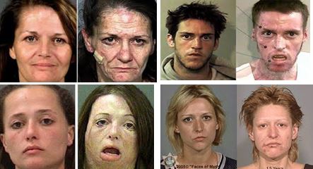 Quelques exemples de photos "avant-après" pour rappeler les dégats que peut provoquer la prise d''ecstasie