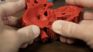 La bio-impression 3D sauve des enfants malades, une première prometteuse