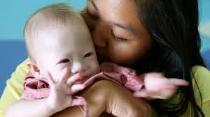 Australie: le père biologique d'un bébé trisomique accusé de vouloir mettre la main sur les dons