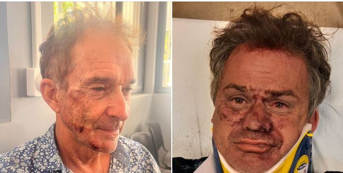 Deux touristes agressés à Papeete