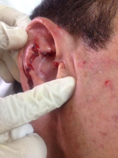 Rikitea : Il mord sa victime au visage