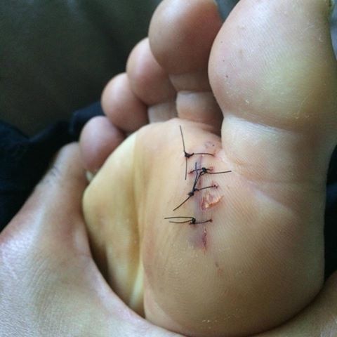 La carrière de surfeur pro réserve bien des aléas.