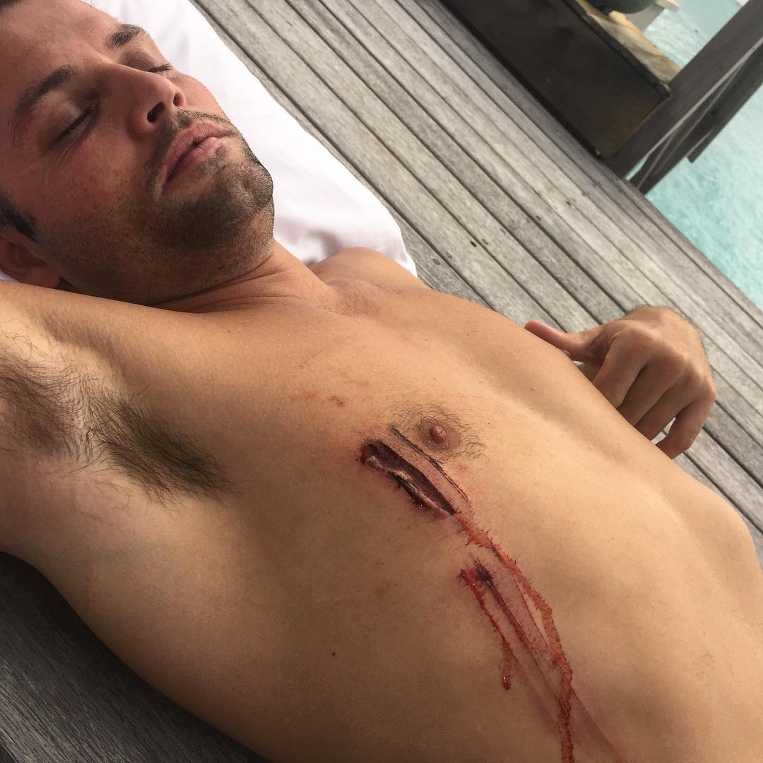 La fausse attaque de requin de Justin Bieber