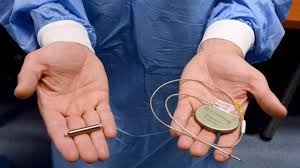 À Tahiti, une opérée du coeur suspendue aux 14% restants de sa batterie