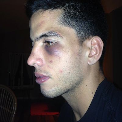 Raihere a du payer le prix pour remporter ce combat