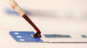 Un test sanguin pourrait prédire une rechute d'un cancer du sein