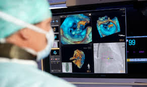 Opération cardiaque pédiatrique: première européenne à Toulouse grâce à un logiciel 3D