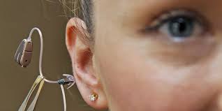 Audioprothèses: des professionnels réclament de meilleurs remboursements de l'Assurance maladie