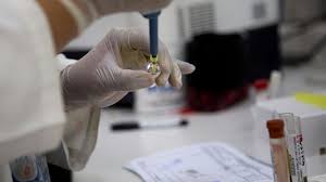 Zika: pas de tests de vaccins à grande échelle avant au moins 18 mois