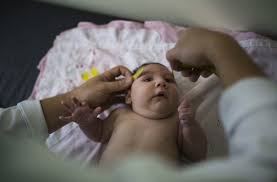 Zika: 641 cas de microcéphalie confirmés, 139 décès au Brésil
