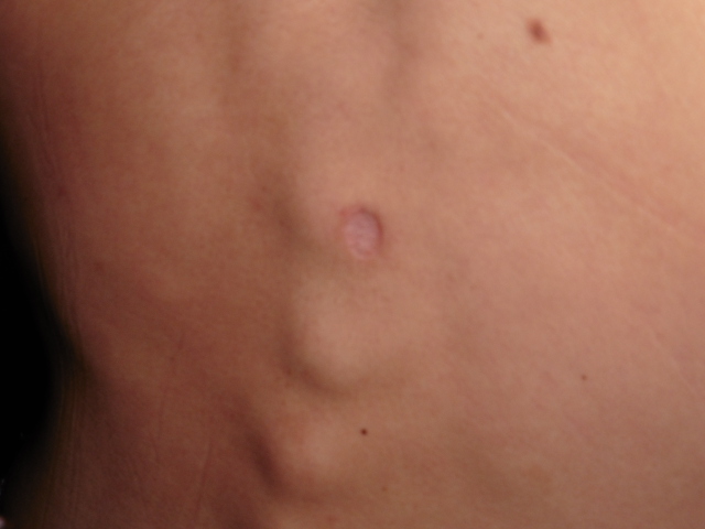 Teikivahimetani, un miraculé devenu joueur de football américain