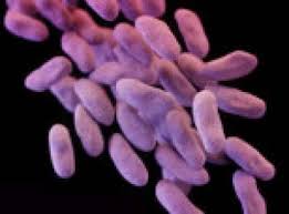 USA: les autorités mobilisées contre la propagation d'une bactérie super-résistante