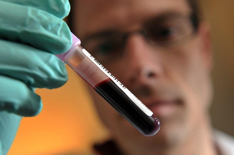 Un simple test sanguin plus efficace pour détecter des cancers