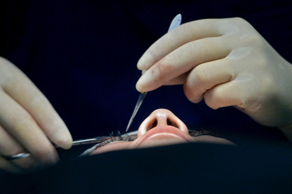 Italie: une femme aveugle recouvre la vue après une greffe inédite