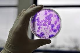 USA: 570 cliniques proposent des soins non-autorisés avec des cellules souches