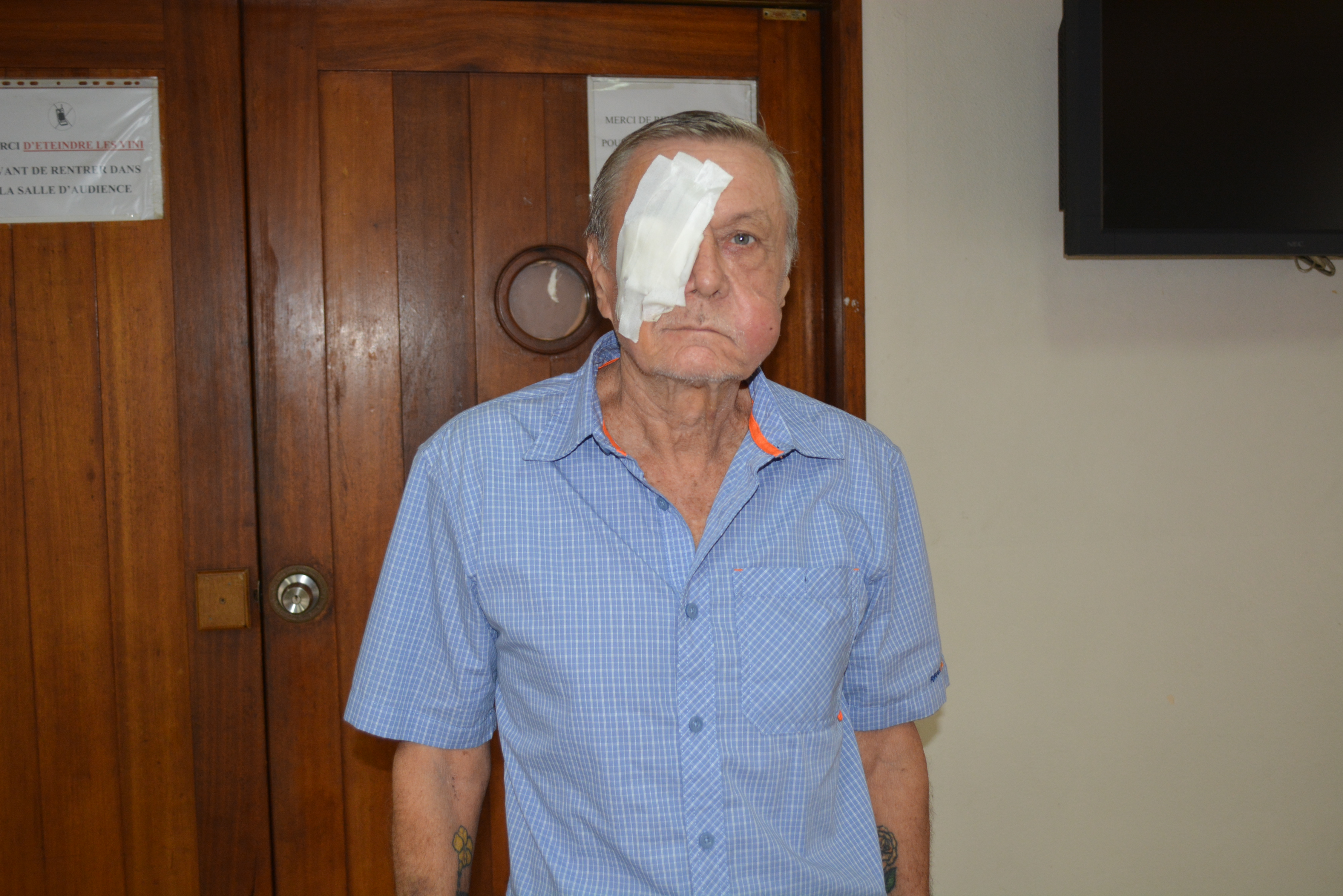 La victime est sortie de l'hopital aujourd'hui, son visage porte les marques de coups très violents.