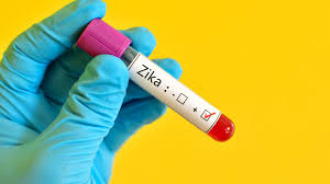 USA: premier cas connu de transmission sexuelle du Zika par une femme