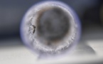 Zika: le 1er trimestre de grossesse est la "période à risque" selon une étude française
