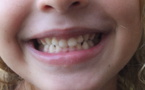 Journal des enfants : Tout savoir sur les dents, organe vivant de la dentition