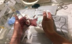 Japon: né à 268 grammes, un bébé garçon quitte l'hôpital en bonne santé