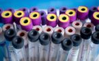 Un test sanguin sur biopuce pourrait révolutionner le dépistage des maladies