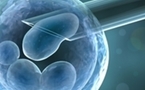 Don de spermatozoïdes ou d'ovocytes : "Donner le bonheur d'être parents"