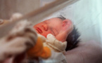 Bébés au bras malformé: probabilité "infime" de trouver la cause