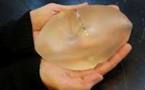Implants PIP: des taux de rupture plus élevés que prévu
