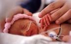 Quinze millions de prématurés par an dans le monde, dont 1,1 million meurent