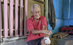 "Trois à huit nouveaux cas de lèpre par an en Polynésie" 