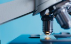 Cancer de la vessie: un test d'urine permettrait une détection précoce