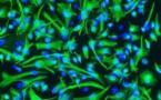 L'existence des cellules souches cancéreuses se confirme