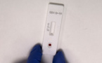 Coronavirus: moment de vérité pour les capacités de dépistage
