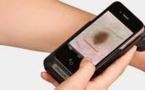 Japon: quand le smartphone se fait presque dermatologue