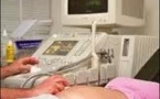 Déclencher les contractions pourrait accroître le risque d'autisme du bébé