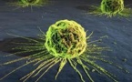 Le coût du cancer en Europe évalué à 126 mds EUR par an