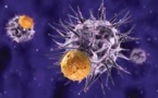 Leucémie aigüe: 88% des malades en rémission grâce à l'immuno-thérapie