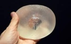 Implants PIP: pas de retrait préventif requis, selon les experts de la Commission Européenne