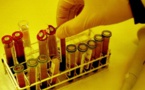 Sida : le bébé américain "guéri" grâce aux antirétroviraux testé séropositif