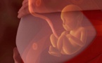 Première naissance chez une femme ayant subi une transplantation d'utérus